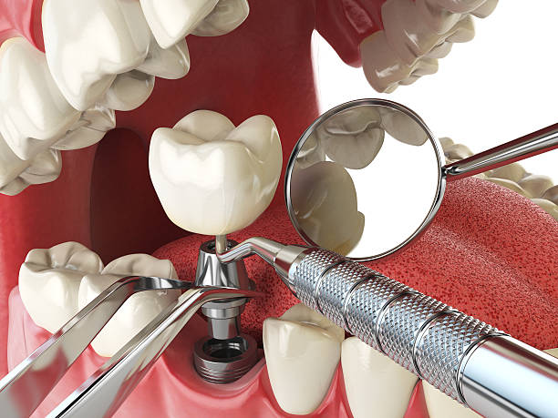 Best Pediatric Emergency Dentist in Columbia, IL