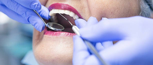 Best Urgent Dental Care for Toothache in Columbia, IL